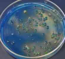 Kulturna svojstva bakterija: definicija, opis, značajke i funkcije