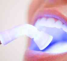Izbjeljivanje zubi izbjeljivački: recenzije, pluses i minus postupci