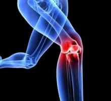 Fizioterapijske vježbe za artroza koljena: vježbe, pravila za njihovu primjenu