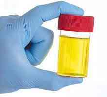 Leukocit esteraza u urinu - što je to? Leukocit esteraza u urinarnoj analizi: transkripta
