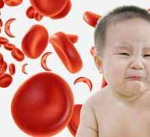 Leukocitoza u djece: uzroci i liječenje