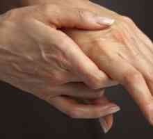 Lijek za zglobove - liječenje artroze