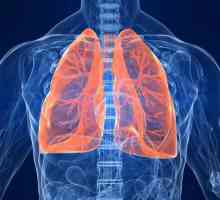 Liječenje lijeve pneumonije: simptomi i liječenje