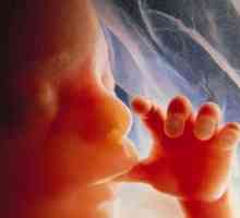 Prezentacija fetusa na licu: posljedice i preporuke liječnika