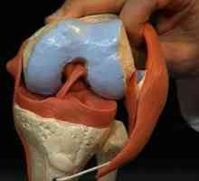 Ligamentoza koljena: što je to, uzroci pojave i liječenja