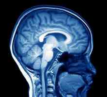 Likvorodinamichesky poremećaji mozga: znakovi, liječenje