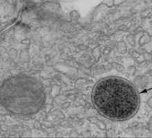 Lizosom: struktura i funkcija stanica organela