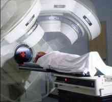 Radioterapija u onkologiji. Posljedice terapije zračenjem