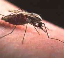 Malarija. Simptomi zarazne bolesti