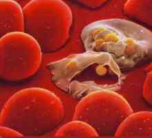 Malarijski plazmodij je Sporoviks tipa. Zašto je ova jedna stanica opasna?