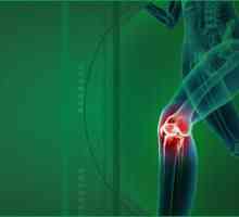 Liječenje artroza zglobova koljena: kako odabrati?