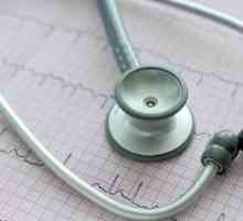 Atrijska fibrilacija srca: što je to i koliko je opasno?