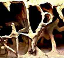 Mikroskopska struktura kostiju. Značajke strukture kostiju