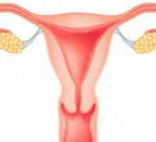 Myoma uterusa (ICD 10: D 25): sorte, simptomi i liječenje