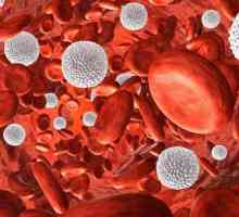 Mnogi leukociti u krvi: uzroci i posljedice