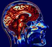 MRI mozga: kako je postupak? Kako se pripremiti za MRI mozga?