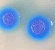 Mycoplasma genitalium: što je to? Koliko je opasna zaraza?