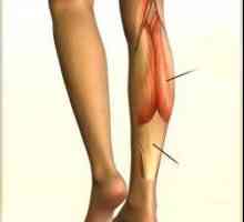 Mišiće šindri, njihov položaj, funkcija i struktura. Prednje i stražnje skupine mišića nogu
