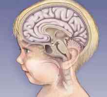 Koliko su ozbiljni učinci meningitisa kod djece?