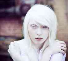 Nastya Zhidkova: albino model s nestandardnim izgledom