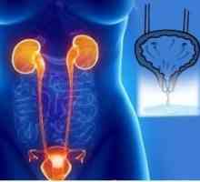 Mokraćna inkontinencija kod starijih žena: liječenje i uzroci