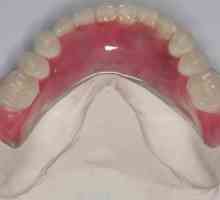 Najlona proteza s potpunim odsutnim zubima i djelomično. Recenzije o najlonskim protezama