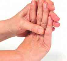 Nemetova ruka: uzroci i odgovarajući tretman