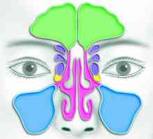 Nos: paranazalni sinusi. CT nad paranazalnim sinusima