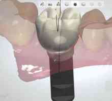Najnovija tehnologija u stomatologiji: pregled metoda, značajki i povratnih informacija