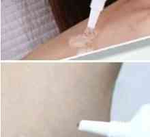Nuobisong (vrhnje): recenzije i učinkovitost. Je li Nuobisong gel ukloniti ožiljke i ožiljke?