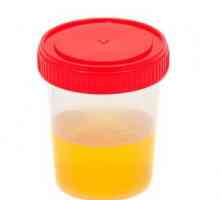 Što će `reći` analizu urina (dekodiranje) u djece