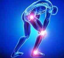 Oslobađanje boli za zglobnu artroza: Popis