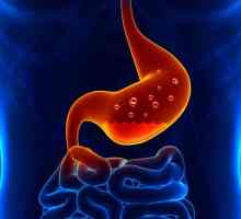 Požara gastritisa: simptomi i liječenje