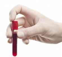 Opći test krvi. Gdje se uzima krv od djece i odraslih s općim testom krvi