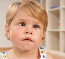 Djecja djeca za liječenje strabizma: opis, obilježja terapije