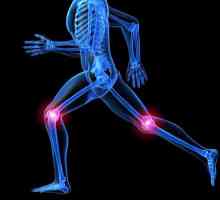 Operacija artroplastije koljena: recenzije. Endoprotetika koljena: rehabilitacija