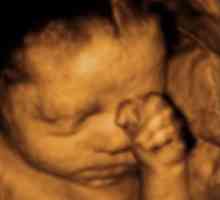 Određivanje spola djeteta ultrazvukom, koliko je točno