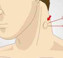 Limfni čvorovi u vratu su poplavljeni: mogući uzroci, simptomi i karakteristike liječenja