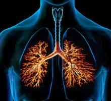 Komplikacije bronhitisa: uzroci i posljedice