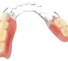Osnovne klasifikacije čeljusti bez zubaca