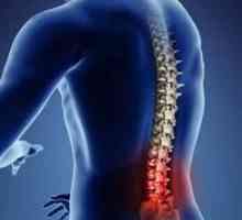 Akutna bol u donjem dijelu leđa: uzroci i liječenje