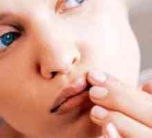 Od onoga što se pojavljuje herpes na usnama: uzroci, prevencija, značajke liječenja