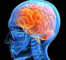 Edem mozga: uzroci i posljedice. Cerebralni edem u djece i odraslih