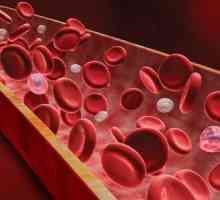Pancitopenija je patološko stanje u kojem smanjuje sastav svih elemenata u krvi koja cirkulira.…