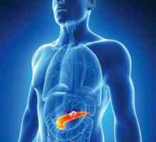 Pancreatitis: što je ova bolest, uzroci, simptomi, liječenje