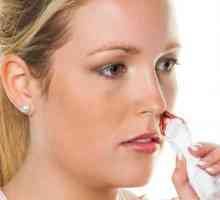 Prednja i stražnja tamponada nosa: oznake i opis postupka