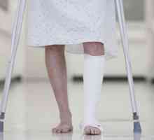Fraktura nogu: simptomi, liječenje i vrijeme oporavka