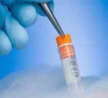 Prijenos krioprezerviranih embrija. In vitro gnojidba