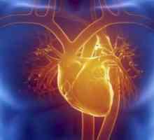 Prva pomoć za infarkt miokarda. Znakovi srčanog udara