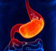 Prehrana s egzacerbacijom gastritisa: terapeutska prehrana